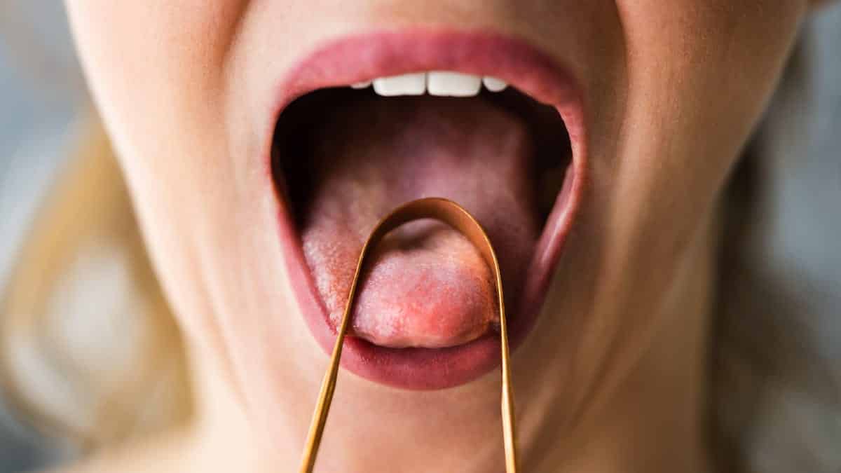 ¿Debe rasparse la lengua todos los días?