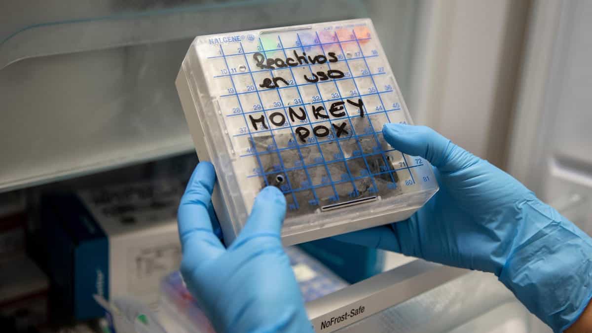 No estamos preparados para la viruela del mono