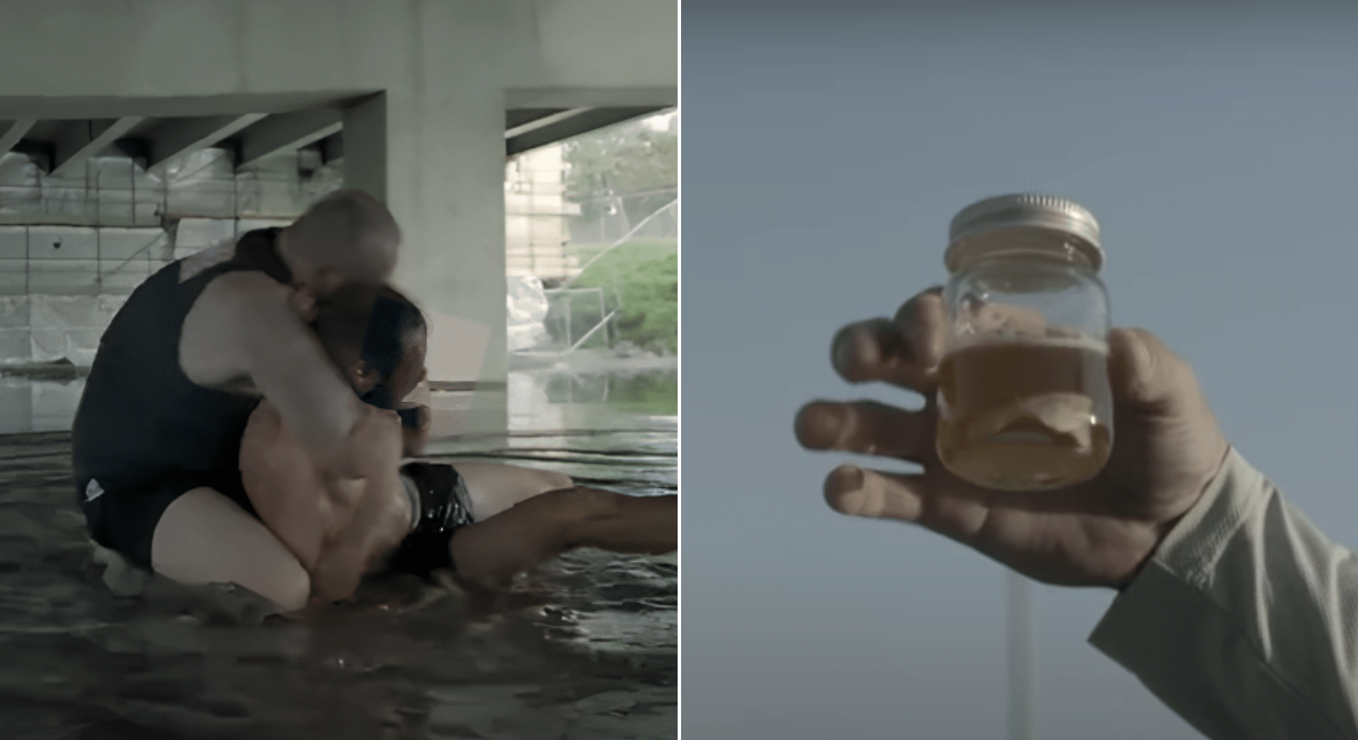 Man keeps his own pickled ear in a jar after it was bitten off